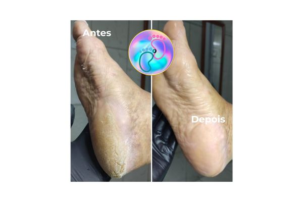 Foto de antes e depois do tratamento 48